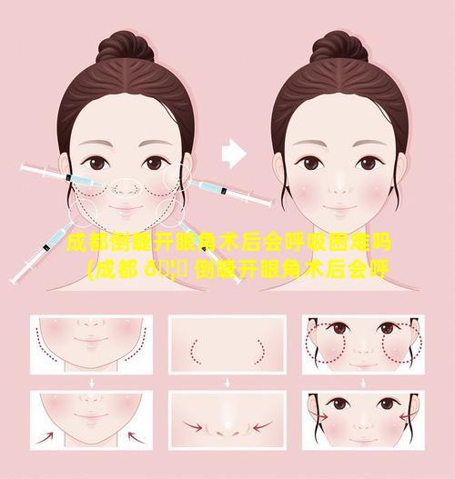 成都倒睫开眼角术后会呼吸困难吗(成都 🦋 倒睫开眼角术后会呼吸 🐛 困难吗多少钱)